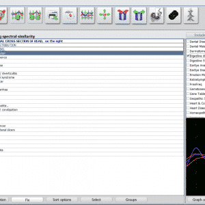 Bioresonance, Quantum Health, : * FOR THOSE WHO ALREADY DID BUY ISHA METATRON- BUT DID NOT BUY A SOFTWARE SUPPORT PACK : NEW * : Special SUPER Offer: ISHA METATRON NLS GR HUNTER PRO - SOFTWARE + DONGLE > Specially for Apprentice Masters Classes : Make your HUNTER POWERFULL ! * including shipment worldwide ! - Image 8